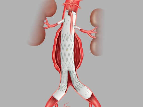 cirurgia-de-alta